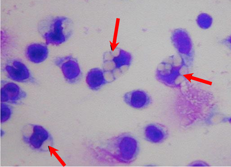 Biological activity of GcMAF